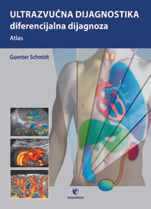 ULTRAZVUČNA DIJAGNOSTIKA - DIFERENCIJALNA DIJAGNOZA