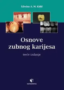 OSNOVE ZUBNOG KARIJESA